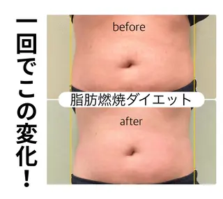 ほねつぎ一休さん 宇品店のエステ・リラクイメージ