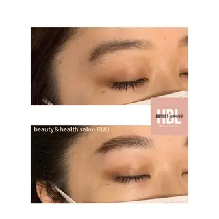 【頭痛、睡眠改善】 salon RUUのエステ・リラクイメージ