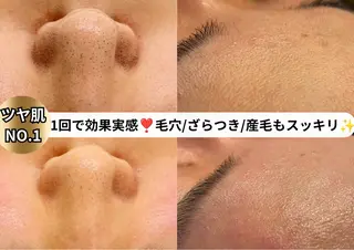 心斎橋/美肌管理専門 muroのエステ・リラクイメージ