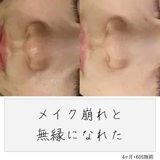 ニキビ経験者が施術 する専門サロン🌻のエステ・リラクイメージ