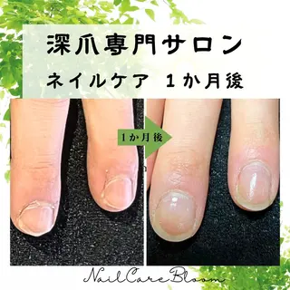 ネイル 深爪専門nail care bloomのネイルデザイン