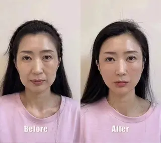 ネイル 愛維美水光専門店 川崎彩鳳のエステ・リラクイメージ