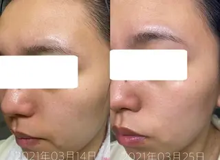 【用賀駅徒歩3分】 肌質改善フェイシャルの眉毛・アイブロウイメージ