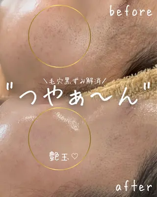 miki 東根の肌質改善サロンのエステ・リラクイメージ