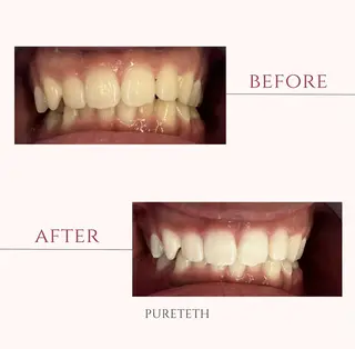 メンズ ホワイトニングサロン PURETETHのエステ・リラクイメージ