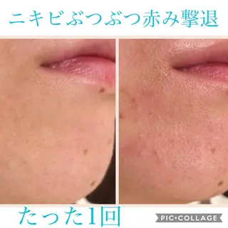 ロング パーマ ヘアアレンジ キッズ ネイル マツエク・マツパ EnsorClair 代表 野口真央のエステ・リラクイメージ