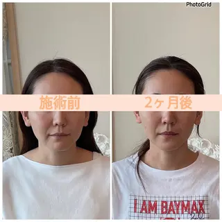 小顔矯正サロン リフェイスフサエのエステ・リラクイメージ