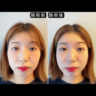 渋谷 美容鍼 首肩こり YZ先生のエステ・リラクイメージ