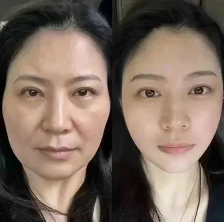 ネイル 愛維美水光専門店 川崎彩鳳のエステ・リラクイメージ