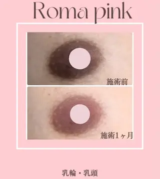 LiLL 熊本のエステ・リラクイメージ