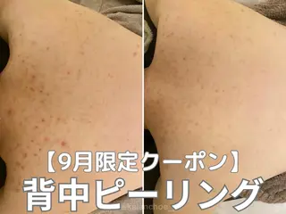 肌質改善 KALANCHOEのエステ・リラクイメージ