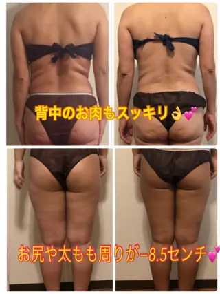 ❤️予約殺到❤️mi オールハンド痩身専門のエステ・リラクイメージ