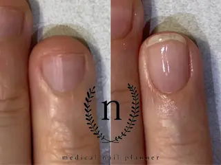 ネイル salon de fika【中崎町】のネイルデザイン