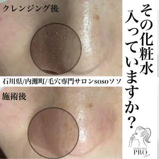 salon soso(ソソ)のエステ・リラクイメージ
