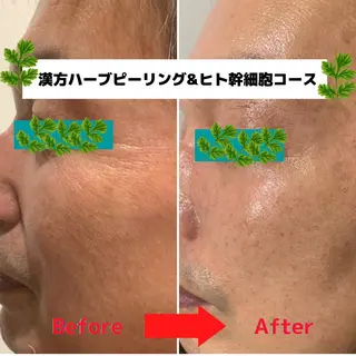 よもぎ蒸しサロン ゆんのエステ・リラクイメージ