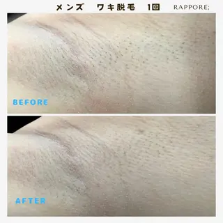 メンズ Rappore; 心斎橋　みずきのエステ・リラクイメージ