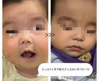 毛穴開き黒ずみ ニキビ特化💆♀️のエステ・リラクイメージ