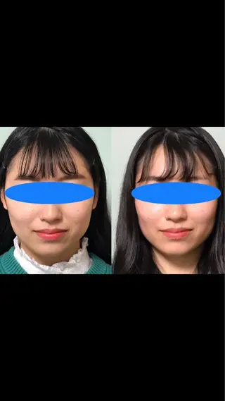 春日井トータルからだ サロンふくふくのエステ・リラクイメージ