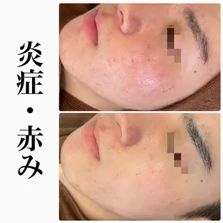 ハーブピーリング専門 BIOPLUS+川崎のエステ・リラクイメージ