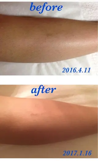 愛維美水光専門店 川崎彩鳳のエステ・リラクイメージ