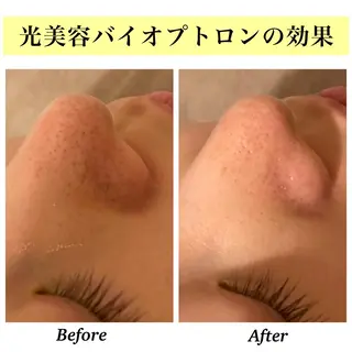 Bellesthe (ベルエステ)のエステ・リラクイメージ