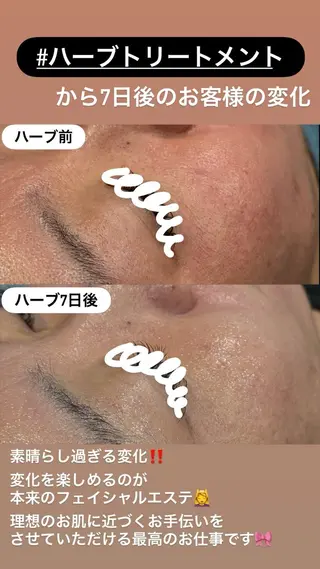 LiZA エステティックサロンのエステ・リラクイメージ