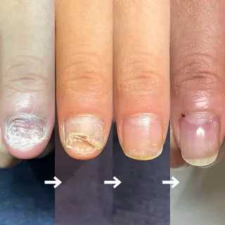 ネイル 自爪育成専門サロン ◌𓈒azumiのネイルデザイン