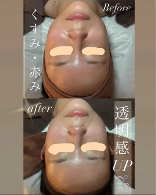 トータルボディケア chouchouのエステ・リラクイメージ