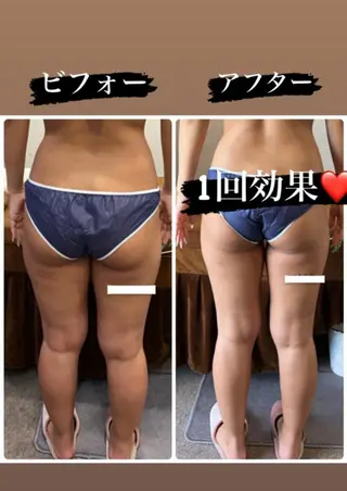 FLEUR 2号店のエステ・リラクイメージ