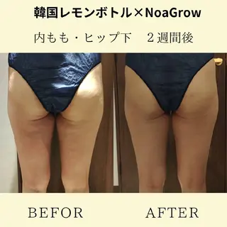 メディカルリンパ ア マテビューティー.Nのエステ・リラクイメージ