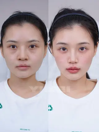 ネイル 愛維美水光専門店 川崎彩鳳のエステ・リラクイメージ