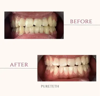 メンズ ホワイトニングサロン PURETETHのエステ・リラクイメージ