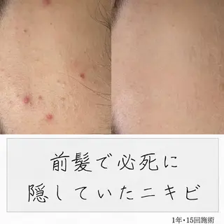ニキビ経験者が施術 する専門サロン🌻のエステ・リラクイメージ