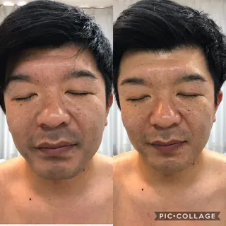 メンズ エステサロン LilyRoseのエステ・リラクイメージ
