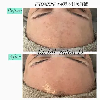 【Salon D】 HALUのエステ・リラクイメージ