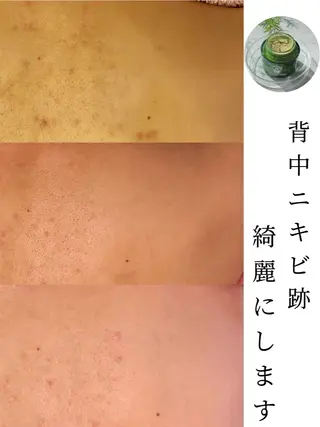 小顔&毛穴・肌質改善 LINDA西宮 AIのエステ・リラクイメージ