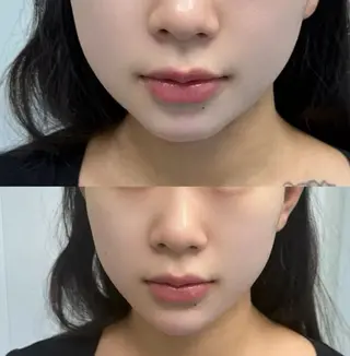 マツエク・マツパ 愛維美水光専門店 川崎彩鳳のエステ・リラクイメージ