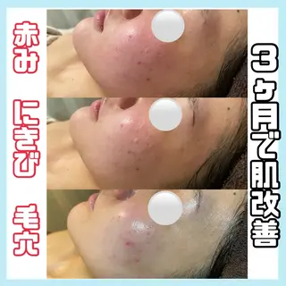 オールハンド専門🤍 痩身/小顔/ ハーブのエステ・リラクイメージ