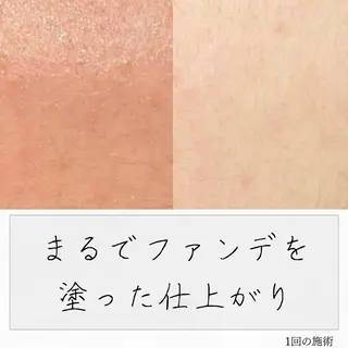 ニキビ経験者が施術 する専門サロン🌻のエステ・リラクイメージ
