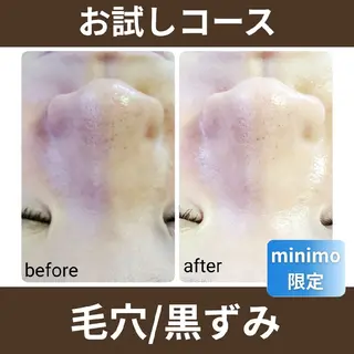 肌悩み解決サロン ハーブピーリングのエステ・リラクイメージ
