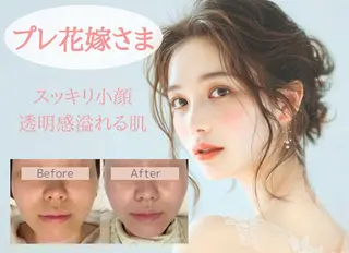 小顔/毛穴/ニキビ salon bealのエステ・リラクイメージ