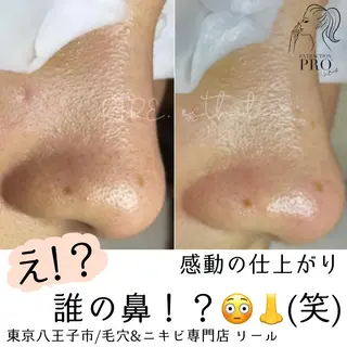 毛穴特化エステ -リールのエステ・リラクイメージ