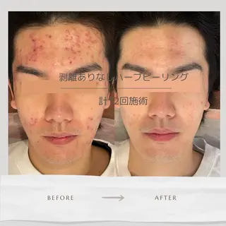 Life Salon別府店のエステ・リラクイメージ