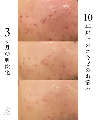 VIVORA ASAMI🌿のエステ・リラクイメージ
