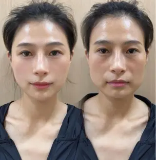 ネイル 愛維美水光専門店 川崎彩鳳のエステ・リラクイメージ