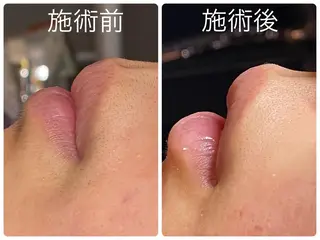 美肌シミケアサロン 4tune.RUMIのその他イメージ
