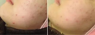 ショート カラー パーマ ヘアアレンジ メンズ キッズ ネイル マツエク・マツパ アニメ,Vオタク× 即効痩せエステサロンのエステ・リラクイメージ