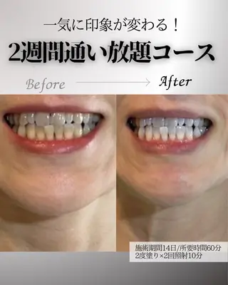 歯科提携エラン ホワイトニング一社店のその他イメージ