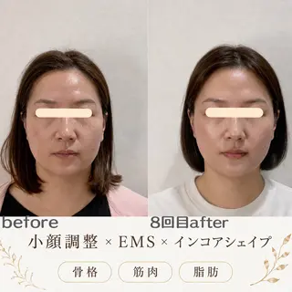 最速小顔・肌質管理 espoirマキのエステ・リラクイメージ