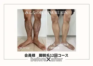 みんなの脱毛 TSURURINのエステ・リラクイメージ